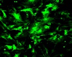 GFP expression in mouse cells, after adenovirus transduction.