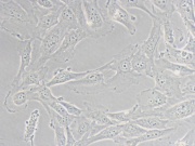 Fibroblastos provenientes de pele humana, imortalizados por SV40 (Aumento: 400X)