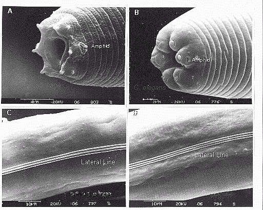 SEM of Nematodes