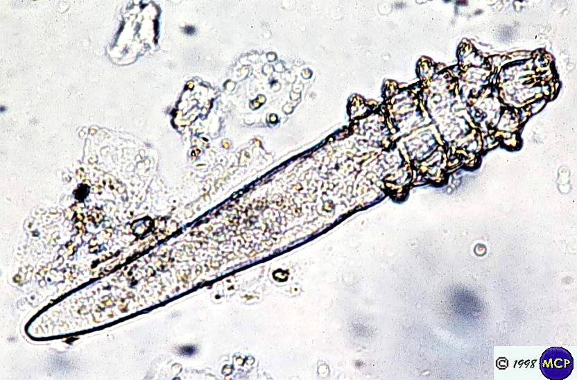 demodex